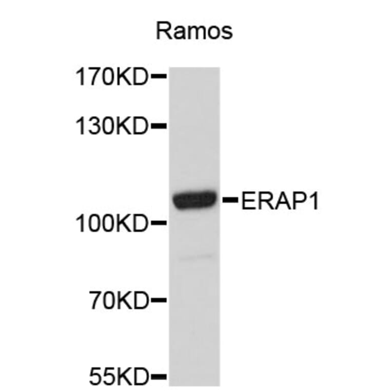 Western Blot - Anti-ERAP1 Antibody (A4762) - Antibodies.com