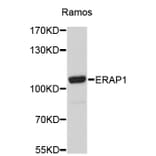 Western Blot - Anti-ERAP1 Antibody (A4762) - Antibodies.com