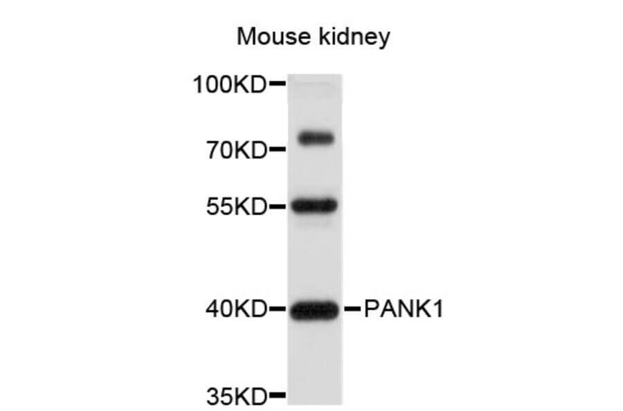 Western Blot - Anti-PANK1 Antibody (A4770) - Antibodies.com