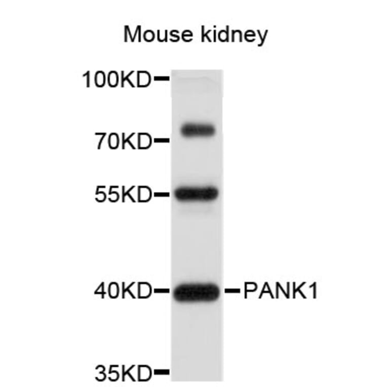 Western Blot - Anti-PANK1 Antibody (A4770) - Antibodies.com