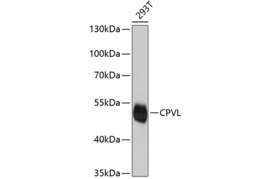 Western Blot - Anti-CPVL Antibody (A4783) - Antibodies.com