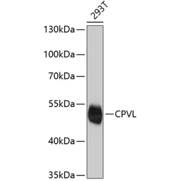 Western Blot - Anti-CPVL Antibody (A4783) - Antibodies.com