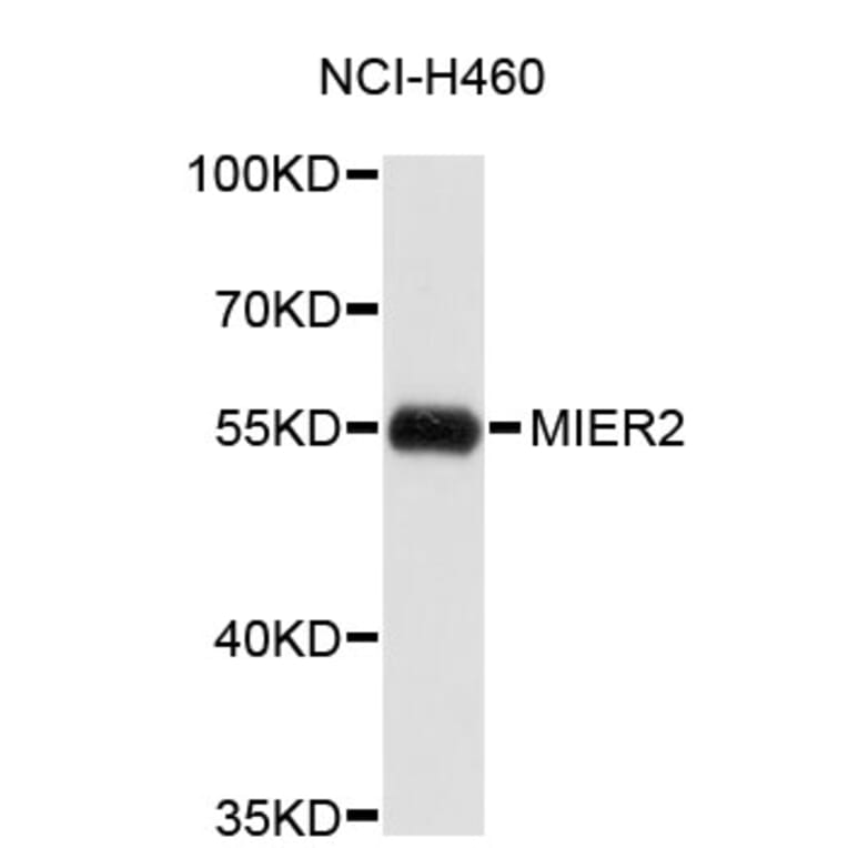 Western Blot - Anti-MIER2 Antibody (A4788) - Antibodies.com