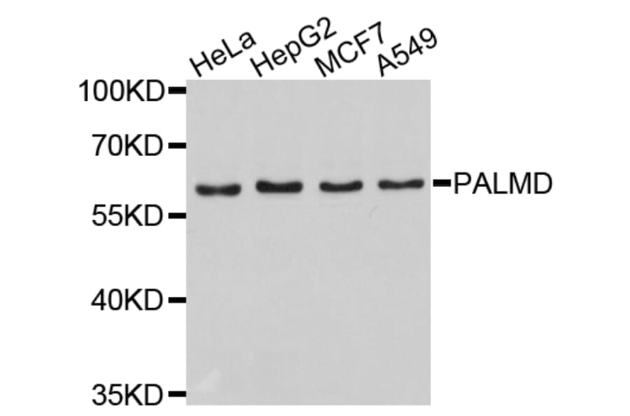 Western Blot - Anti-PALMD Antibody (A4801) - Antibodies.com
