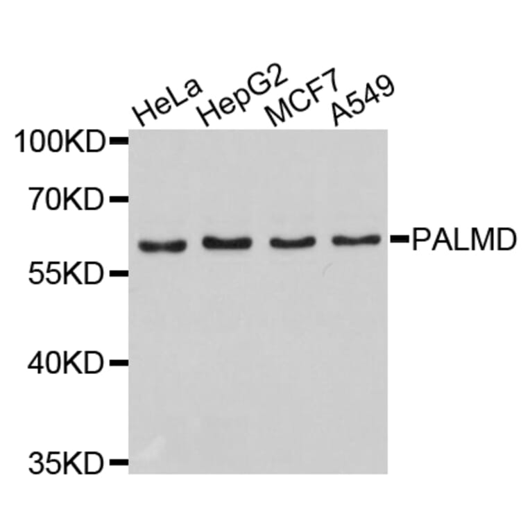 Western Blot - Anti-PALMD Antibody (A4801) - Antibodies.com