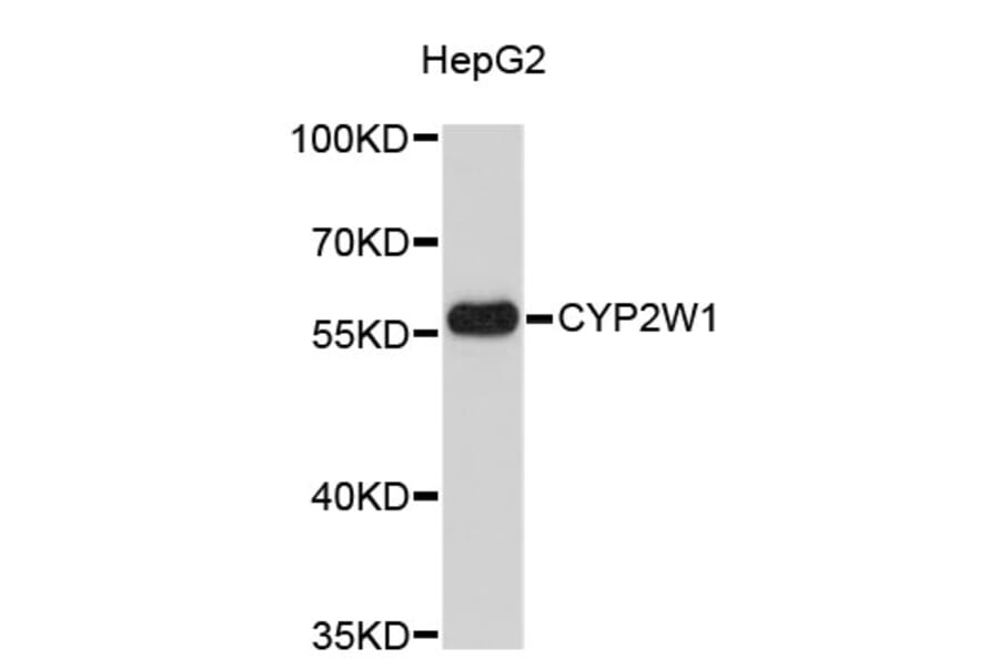 Western Blot - Anti-CYP2W1 Antibody (A4803) - Antibodies.com