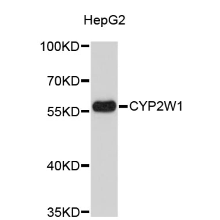 Western Blot - Anti-CYP2W1 Antibody (A4803) - Antibodies.com