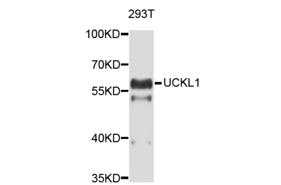 Western Blot - Anti-UCKL1 Antibody (A4806) - Antibodies.com