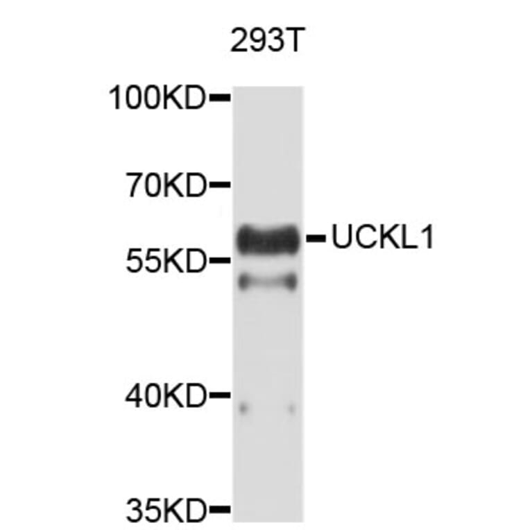Western Blot - Anti-UCKL1 Antibody (A4806) - Antibodies.com