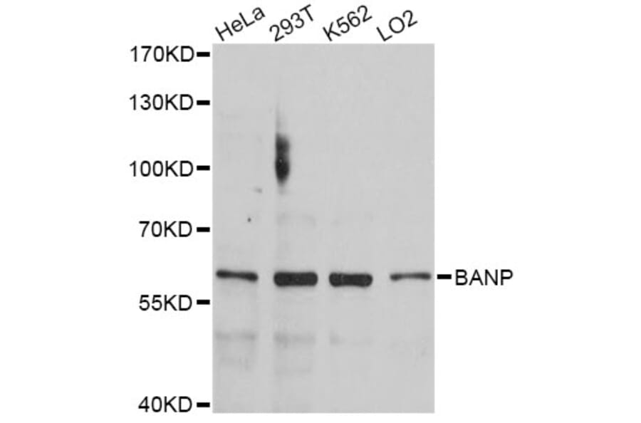 Western Blot - Anti-BANP Antibody (A4807) - Antibodies.com