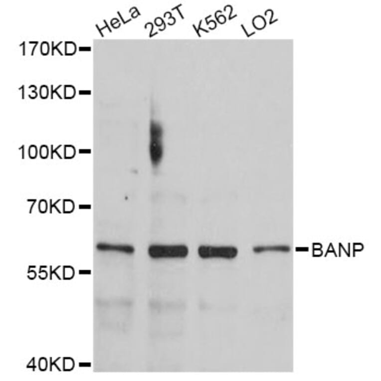 Western Blot - Anti-BANP Antibody (A4807) - Antibodies.com