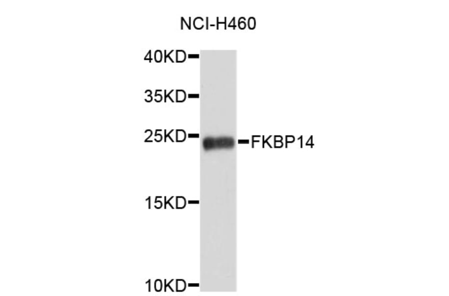 Western Blot - Anti-FKBP14 Antibody (A4810) - Antibodies.com
