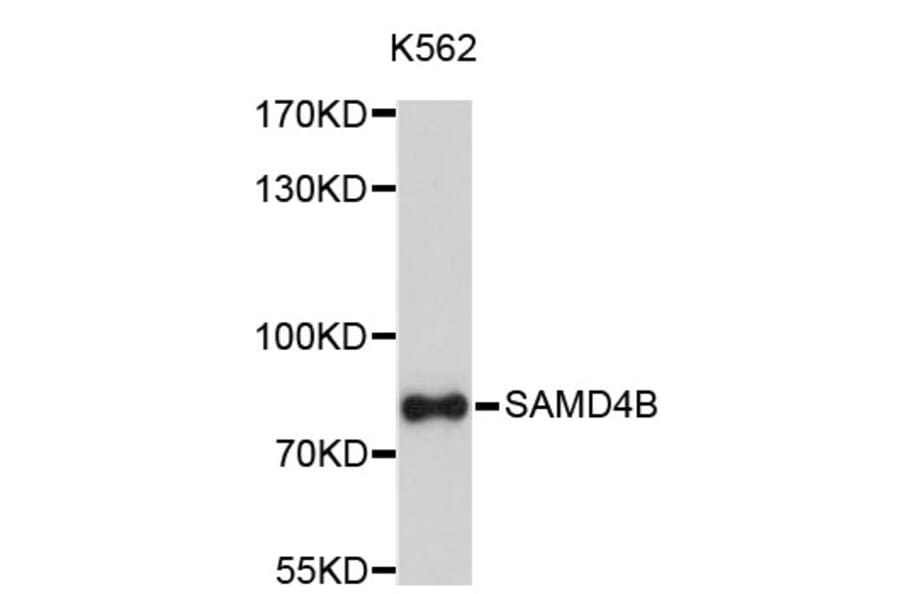 Western Blot - Anti-SAMD4B Antibody (A4811) - Antibodies.com