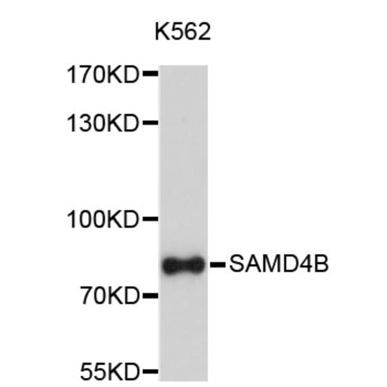 Western Blot - Anti-SAMD4B Antibody (A4811) - Antibodies.com