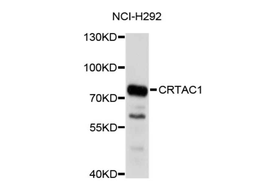 Western Blot - Anti-CRTAC1 Antibody (A4812) - Antibodies.com