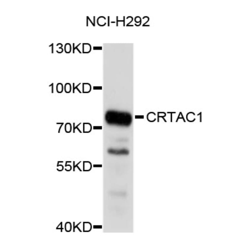 Western Blot - Anti-CRTAC1 Antibody (A4812) - Antibodies.com