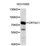 Western Blot - Anti-CRTAC1 Antibody (A4812) - Antibodies.com