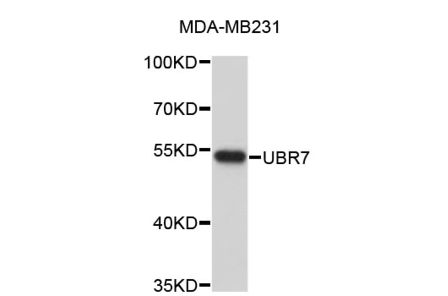 Western Blot - Anti-UBR7 Antibody (A4813) - Antibodies.com