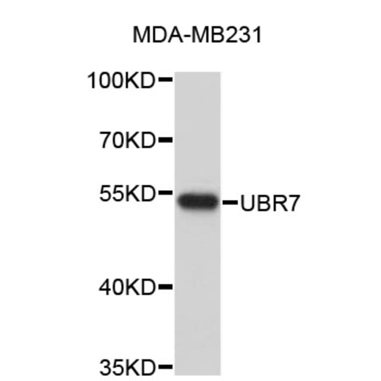 Western Blot - Anti-UBR7 Antibody (A4813) - Antibodies.com