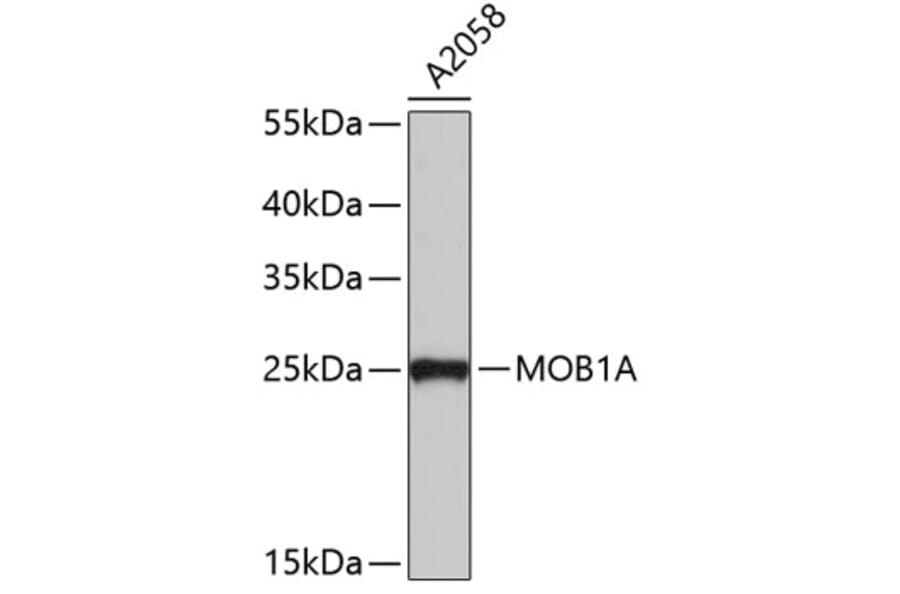 Western Blot - Anti-MOB1A Antibody (A4818) - Antibodies.com