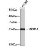 Western Blot - Anti-MOB1A Antibody (A4818) - Antibodies.com