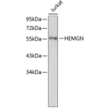 Western Blot - Anti-HEMGN Antibody (A4830) - Antibodies.com