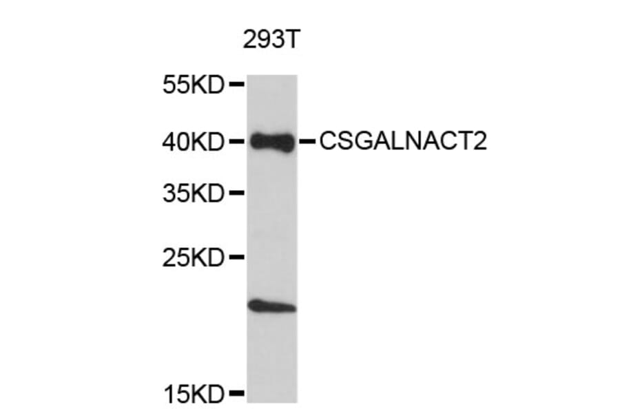 Western Blot - Anti-CSGALNACT2 Antibody (A4833) - Antibodies.com