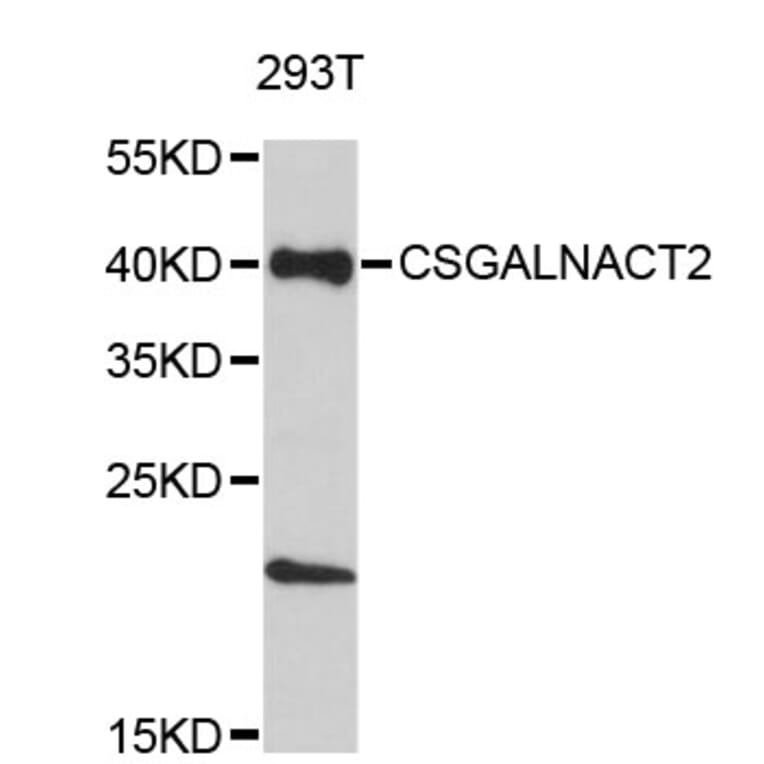 Western Blot - Anti-CSGALNACT2 Antibody (A4833) - Antibodies.com