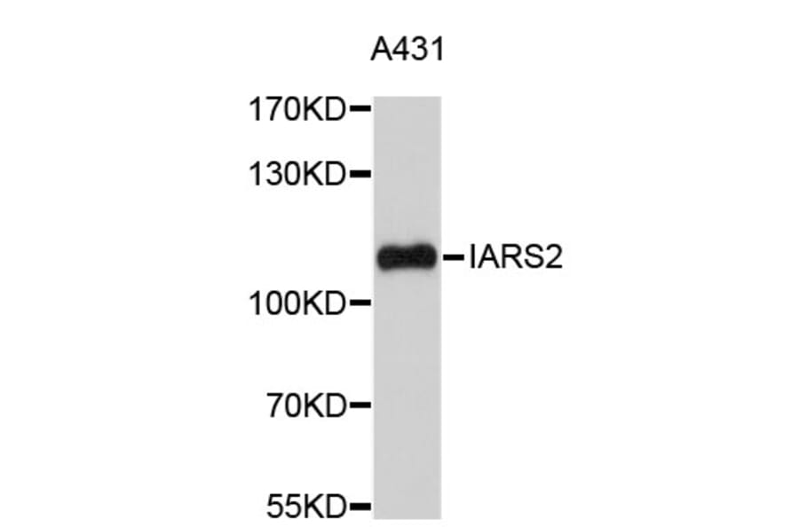 Western Blot - Anti-IARS2 Antibody (A4841) - Antibodies.com