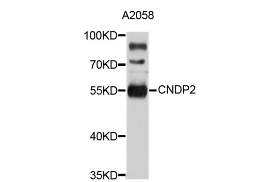 Western Blot - Anti-CNDP2 Antibody (A4845) - Antibodies.com