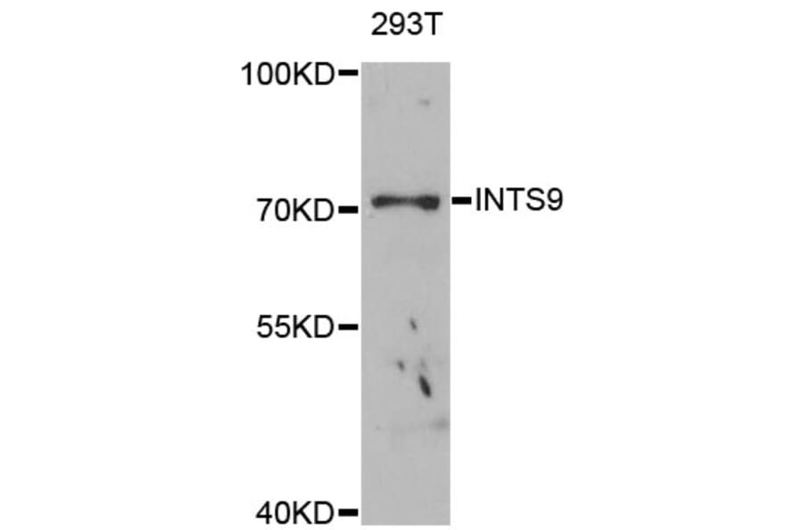 Western Blot - Anti-INTS9 Antibody (A4847) - Antibodies.com