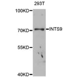 Western Blot - Anti-INTS9 Antibody (A4847) - Antibodies.com