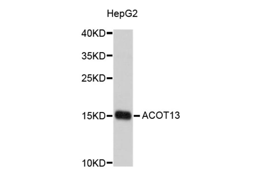 Western Blot - Anti-ACOT13 Antibody (A4851) - Antibodies.com