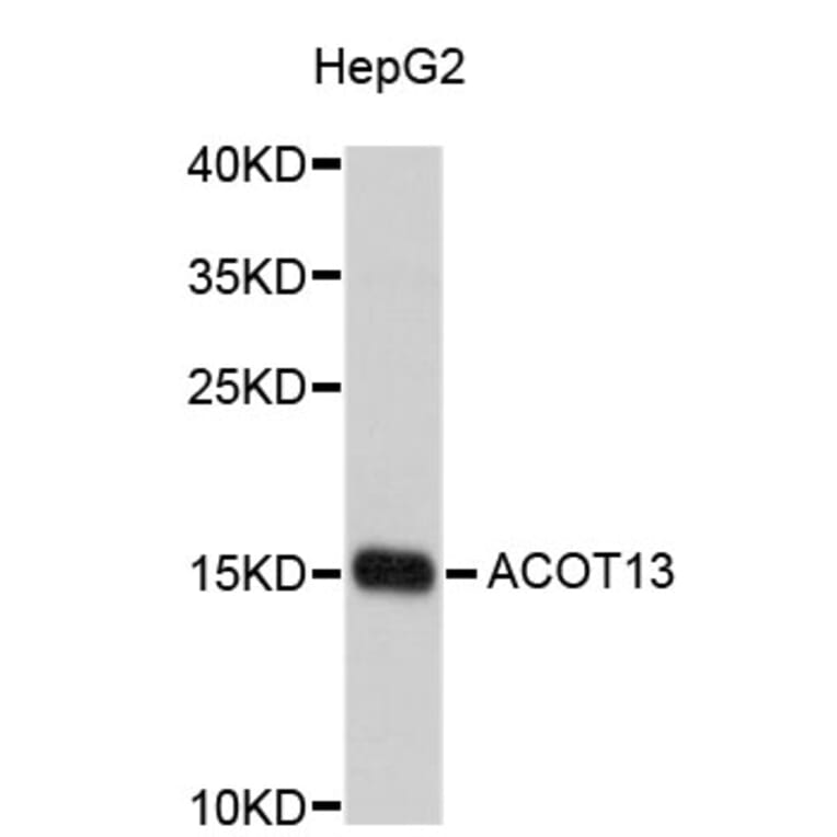 Western Blot - Anti-ACOT13 Antibody (A4851) - Antibodies.com
