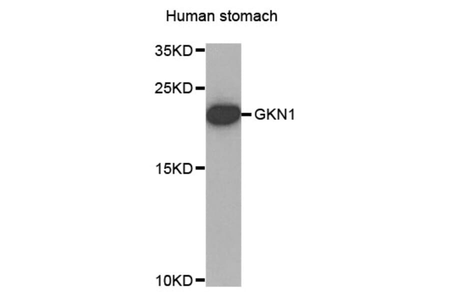 Western Blot - Anti-GKN1 Antibody (A4862) - Antibodies.com