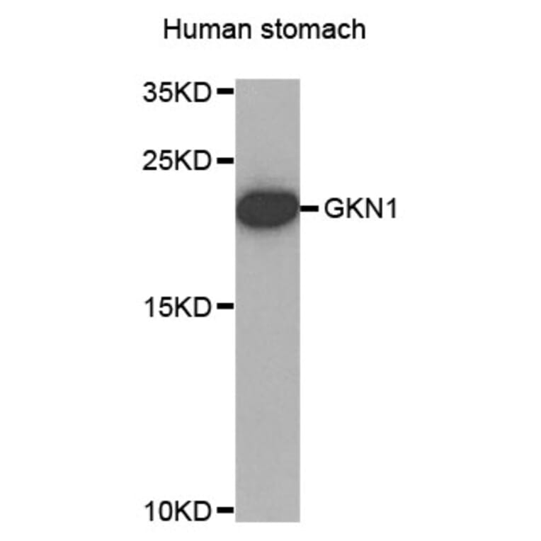 Western Blot - Anti-GKN1 Antibody (A4862) - Antibodies.com