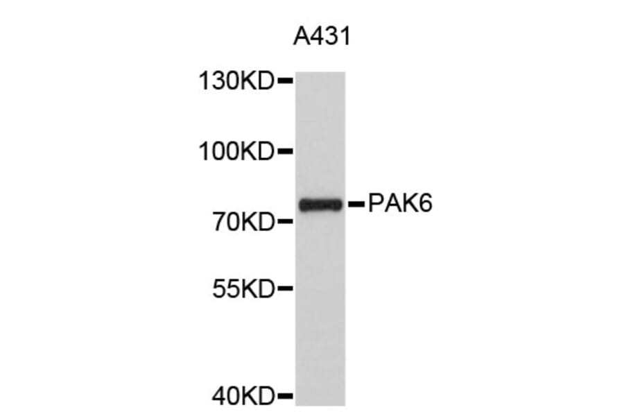 Western Blot - Anti-PAK6 Antibody (A4871) - Antibodies.com