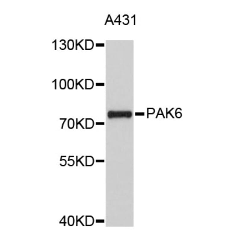 Western Blot - Anti-PAK6 Antibody (A4871) - Antibodies.com