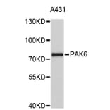 Western Blot - Anti-PAK6 Antibody (A4871) - Antibodies.com