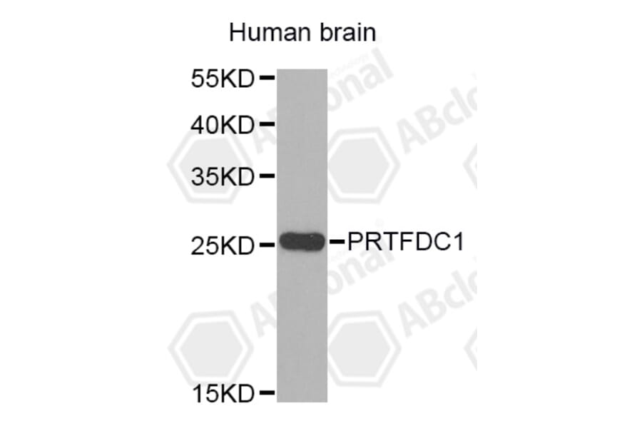 Western Blot - Anti-PRTFDC1 Antibody (A4875) - Antibodies.com