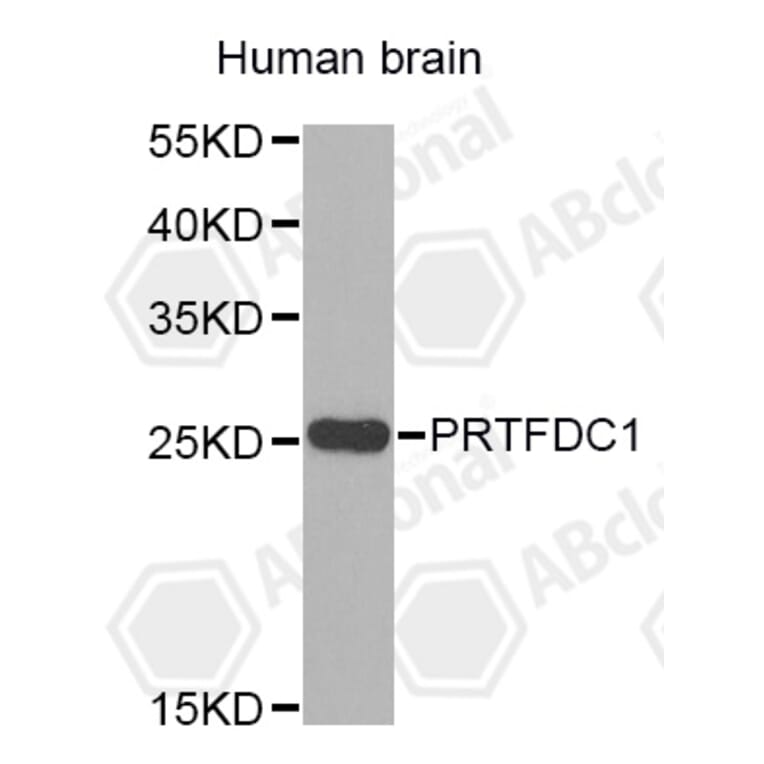 Western Blot - Anti-PRTFDC1 Antibody (A4875) - Antibodies.com