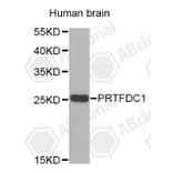 Western Blot - Anti-PRTFDC1 Antibody (A4875) - Antibodies.com