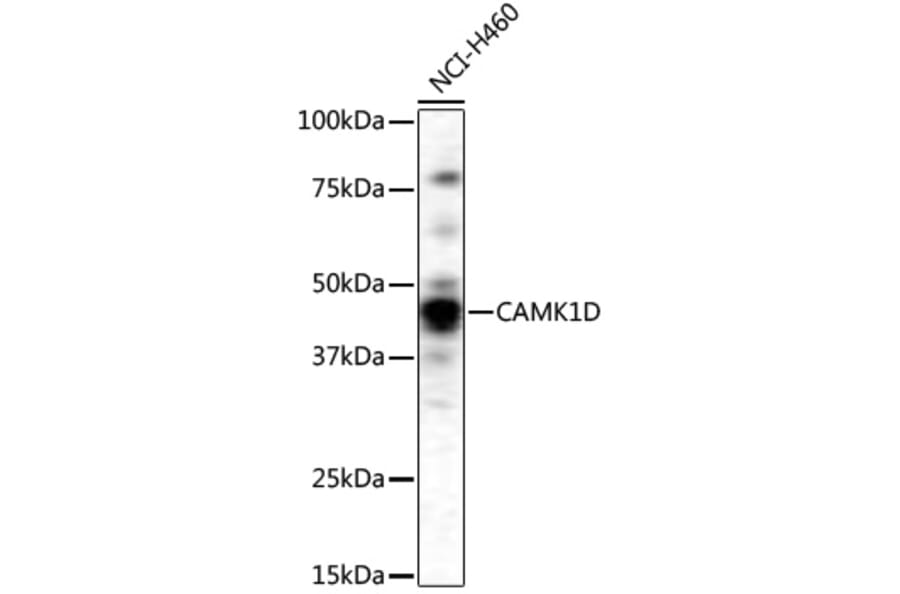 Western Blot - Anti-CAMK1D Antibody (A4886) - Antibodies.com