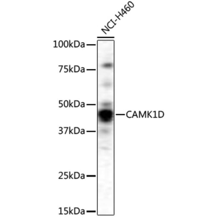 Western Blot - Anti-CAMK1D Antibody (A4886) - Antibodies.com