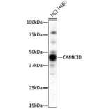 Western Blot - Anti-CAMK1D Antibody (A4886) - Antibodies.com