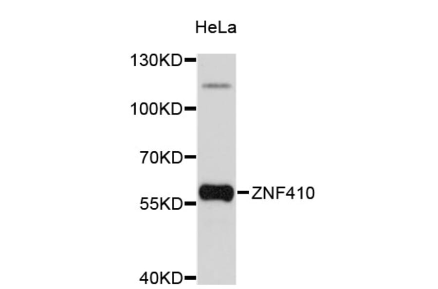 Western Blot - Anti-ZNF410 Antibody (A4901) - Antibodies.com