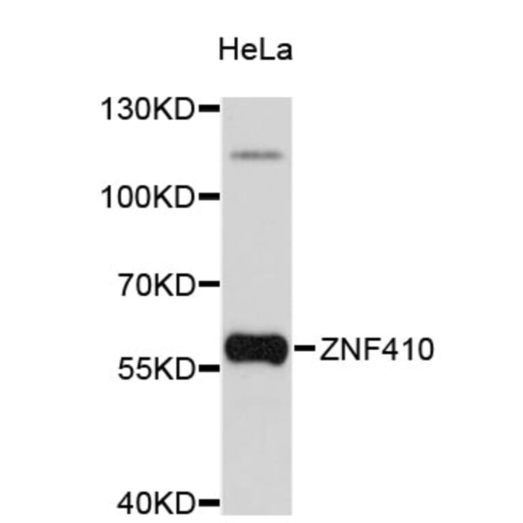 Western Blot - Anti-ZNF410 Antibody (A4901) - Antibodies.com