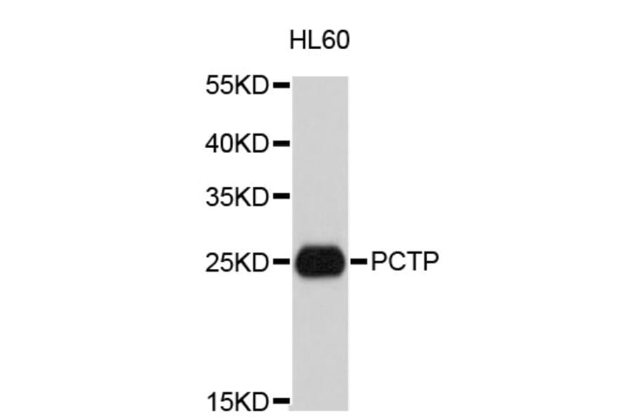 Western Blot - Anti-PCTP Antibody (A4904) - Antibodies.com