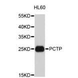 Western Blot - Anti-PCTP Antibody (A4904) - Antibodies.com