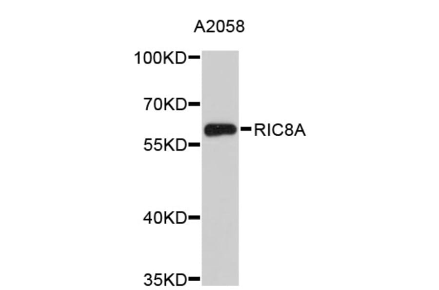 Western Blot - Anti-RIC8A Antibody (A4910) - Antibodies.com